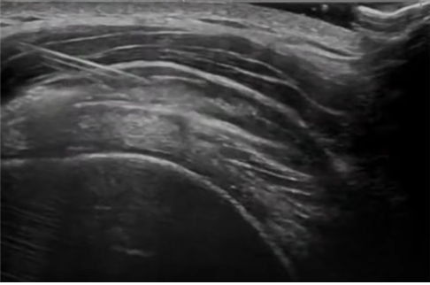 b9dbd2e78d932848c90eb782f12611c7_1755614880_678.png b9dbd2e78d932848c90eb782f12611c7_1755614880_678.png